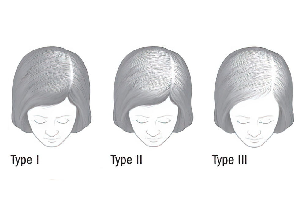 Hair Loss 101: What You Need to Know for Thicker, Fuller Strands
