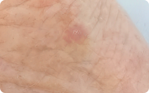 After image