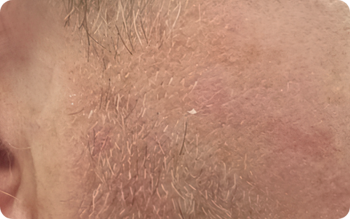 After image