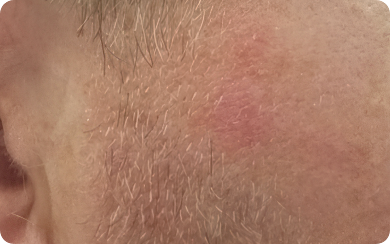 Before image
