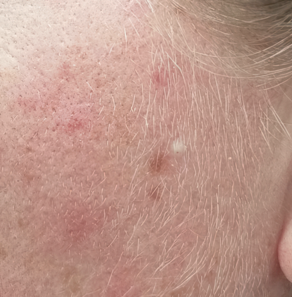 Before image