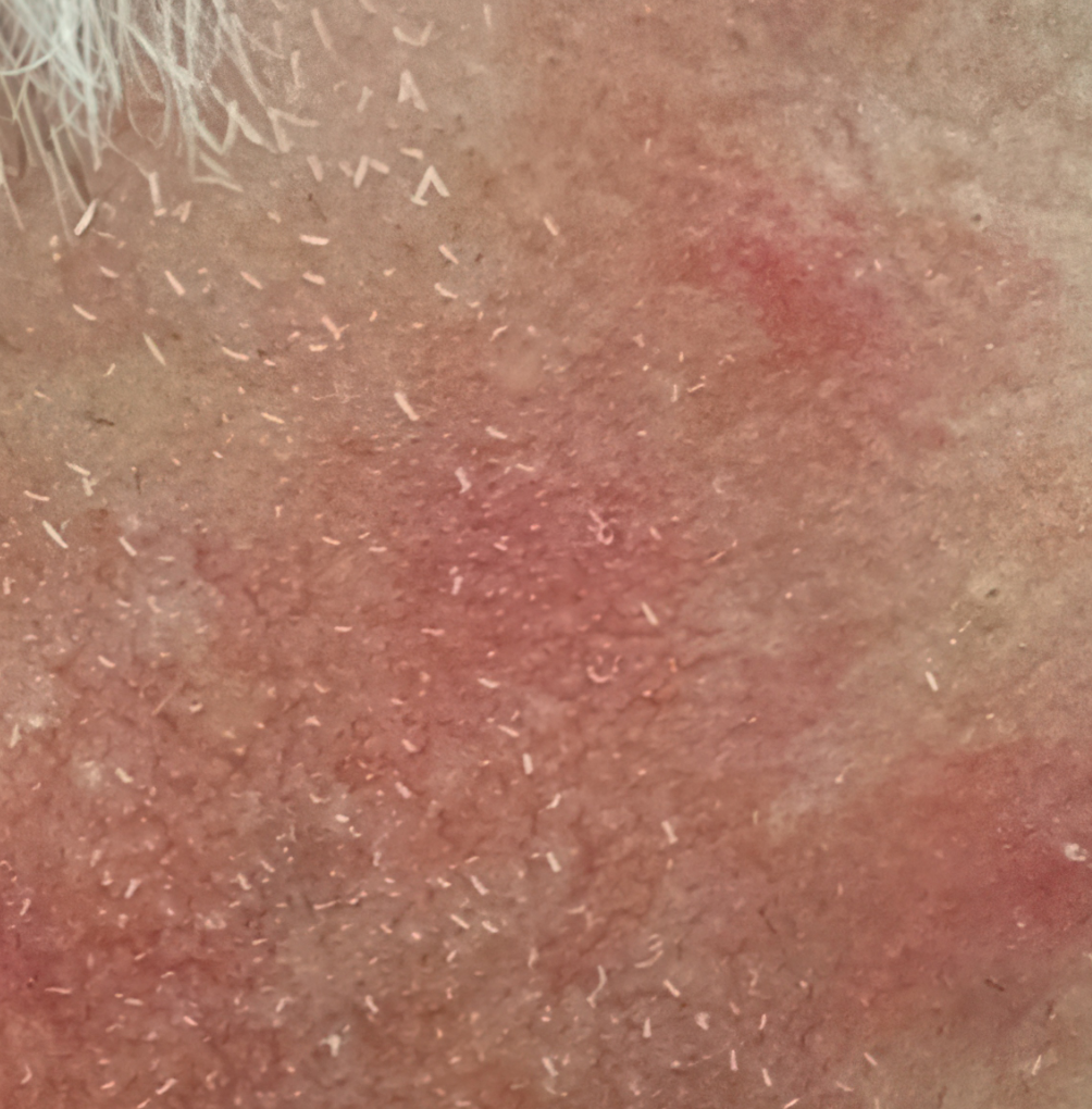 Before image