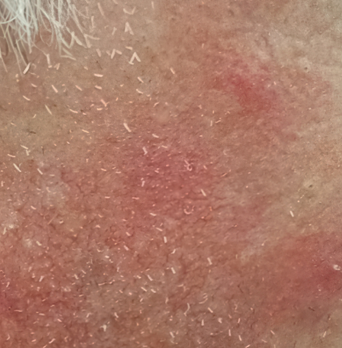 Before image