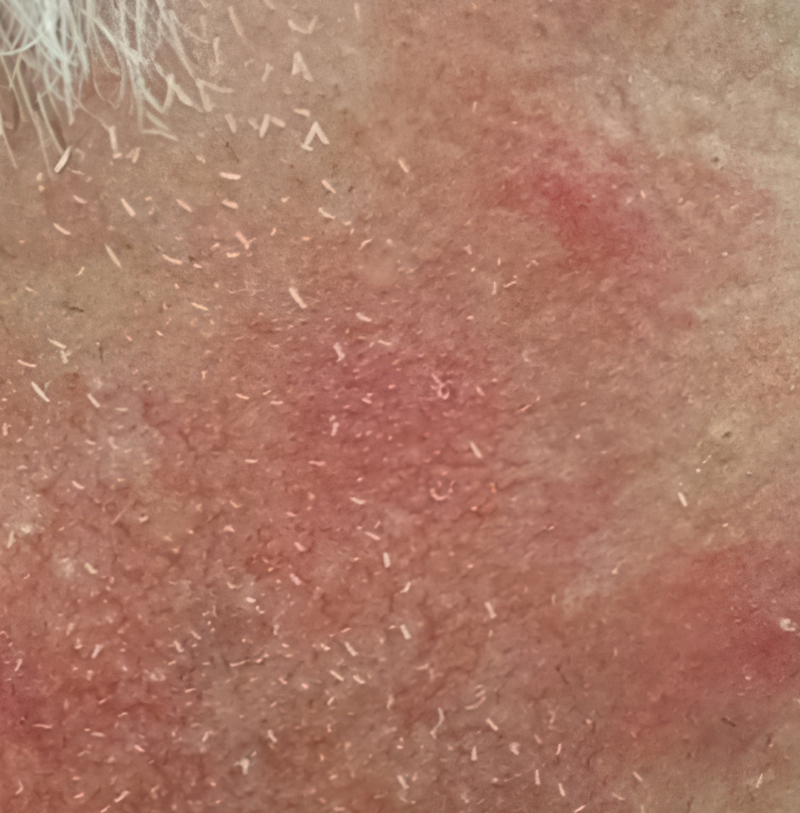 Before image