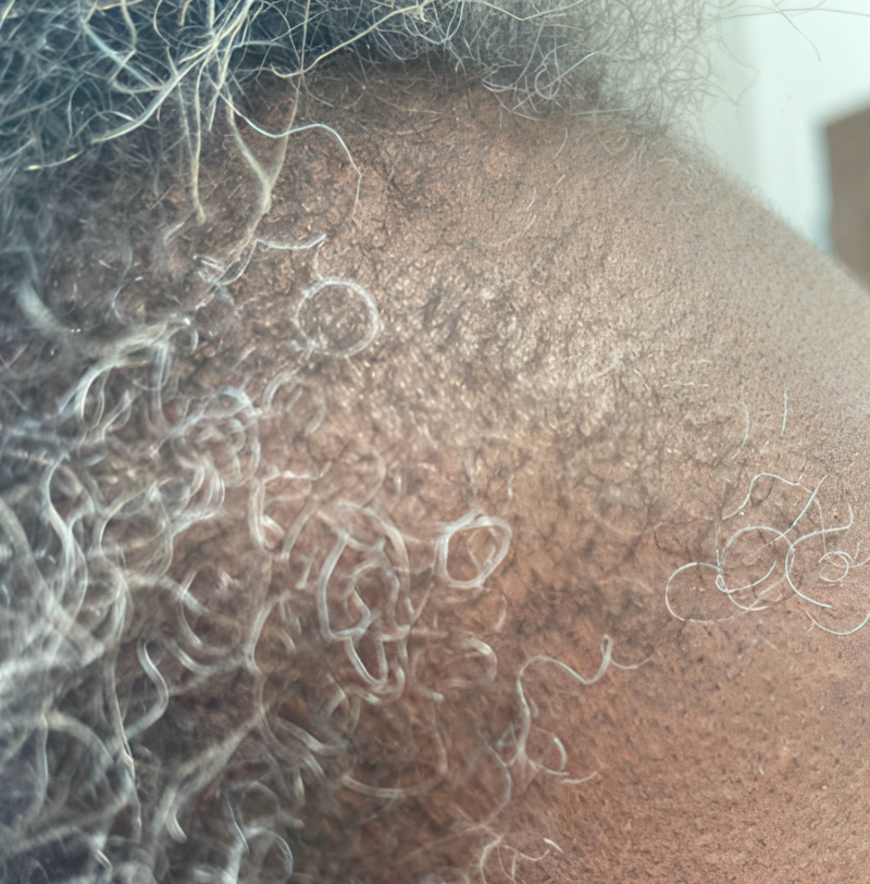 Before image