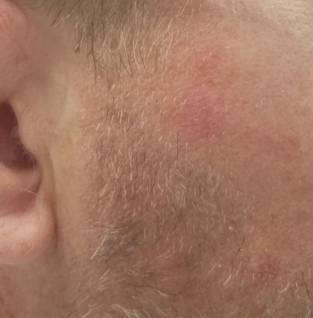 Before image